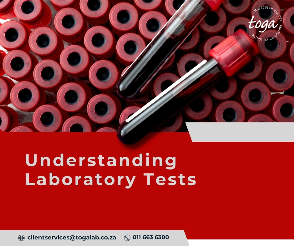 laboratory tests